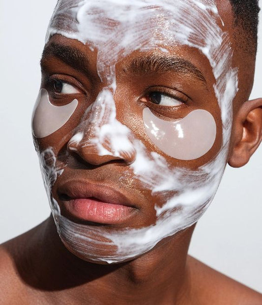 How to manage Melasma